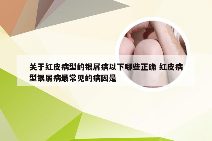 关于红皮病型的银屑病以下哪些正确 红皮病型银屑病最常见的病因是