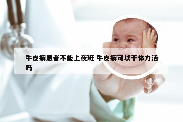 牛皮癣患者不能上夜班 牛皮癣可以干体力活吗