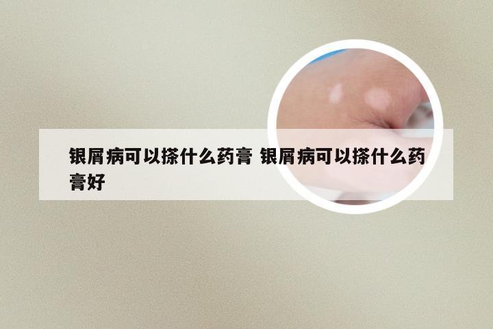 银屑病可以搽什么药膏 银屑病可以搽什么药膏好