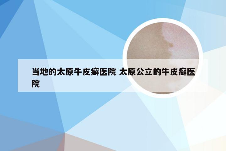 当地的太原牛皮癣医院 太原公立的牛皮癣医院