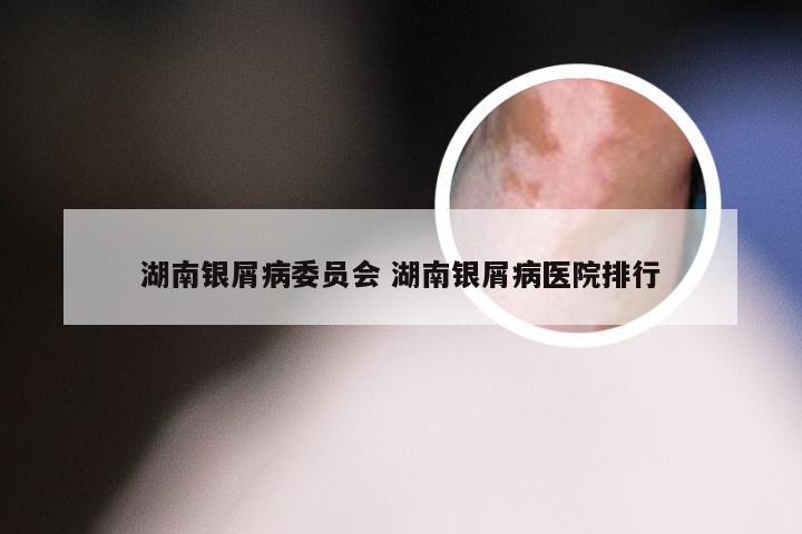 湖南银屑病委员会 湖南银屑病医院排行