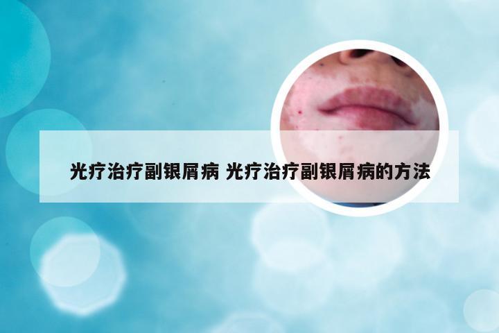 光疗治疗副银屑病 光疗治疗副银屑病的方法