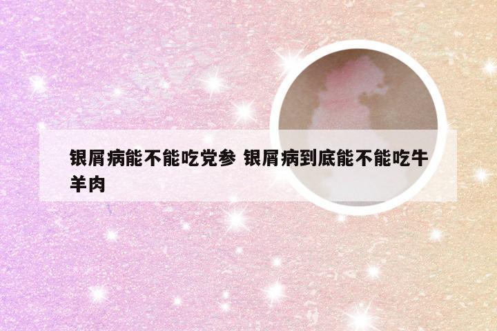 银屑病能不能吃党参 银屑病到底能不能吃牛羊肉