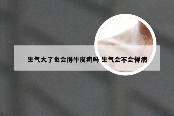 生气大了也会得牛皮癣吗 生气会不会得病