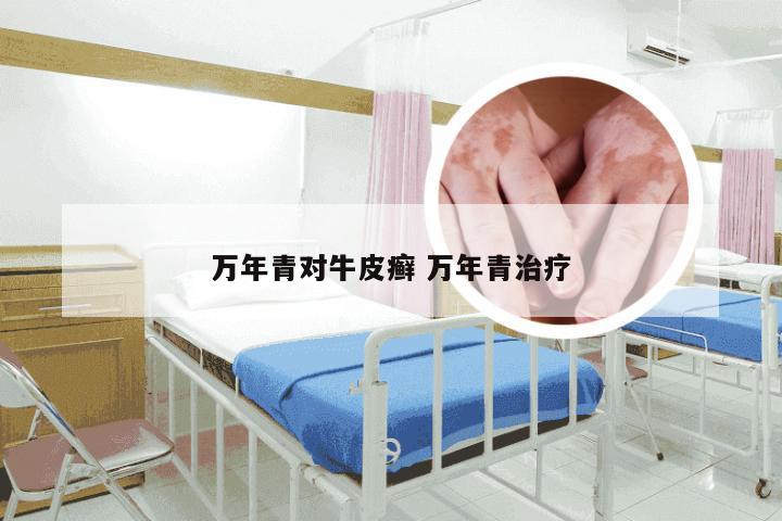 万年青对牛皮癣 万年青治疗