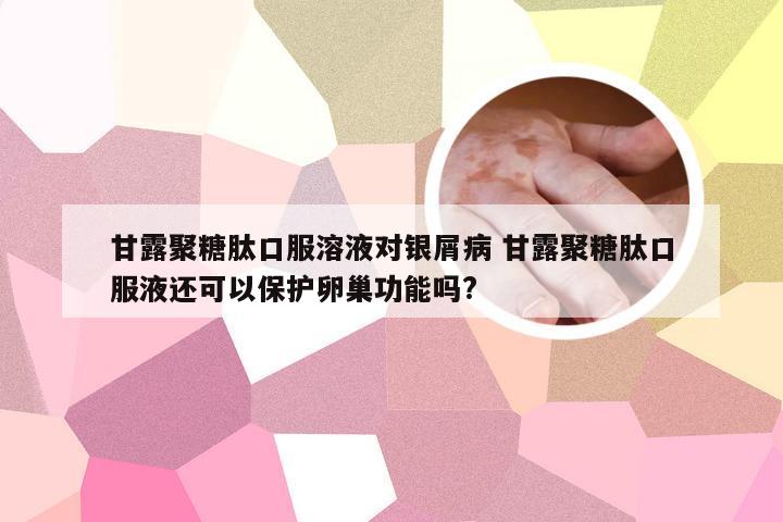 甘露聚糖肽口服溶液对银屑病 甘露聚糖肽口服液还可以保护卵巢功能吗?