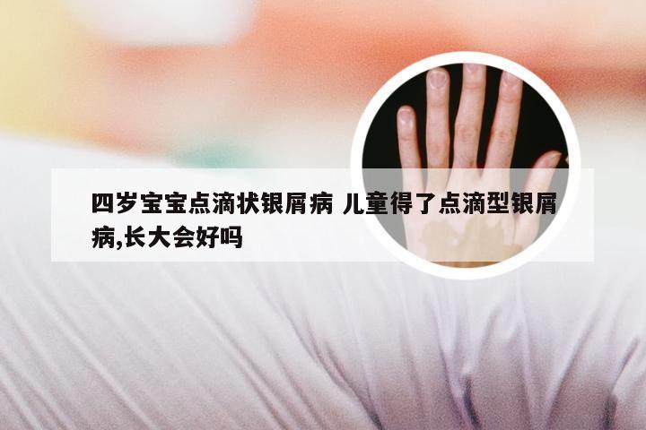 四岁宝宝点滴状银屑病 儿童得了点滴型银屑病,长大会好吗