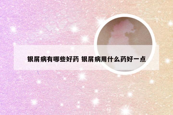 银屑病有哪些好药 银屑病用什么药好一点