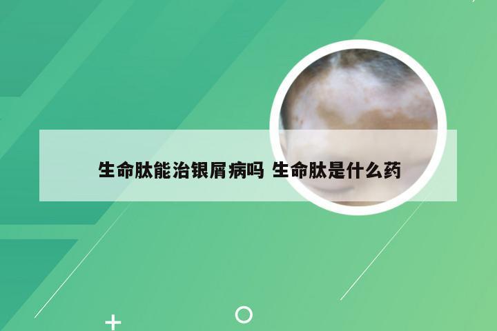 生命肽能治银屑病吗 生命肽是什么药