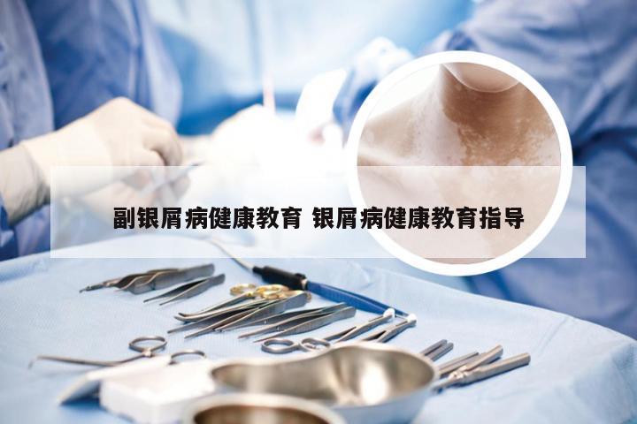 副银屑病健康教育 银屑病健康教育指导