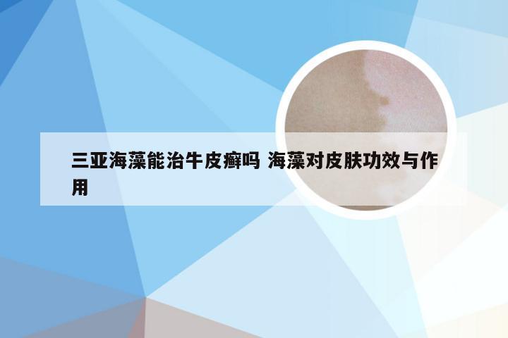 三亚海藻能治牛皮癣吗 海藻对皮肤功效与作用