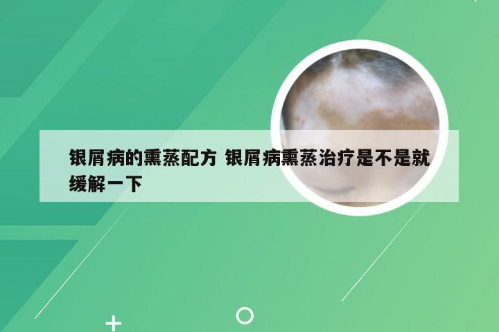 银屑病的熏蒸配方 银屑病熏蒸治疗是不是就缓解一下