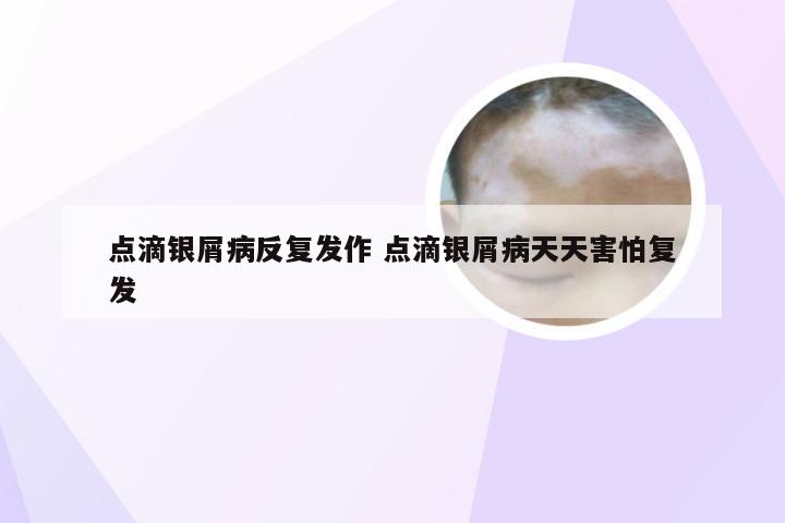 点滴银屑病反复发作 点滴银屑病天天害怕复发