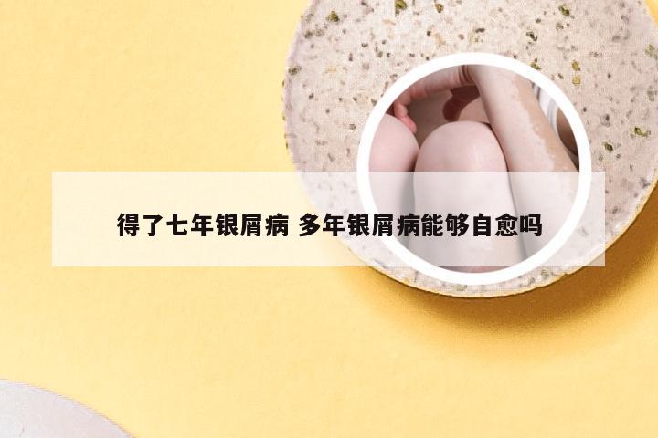 得了七年银屑病 多年银屑病能够自愈吗