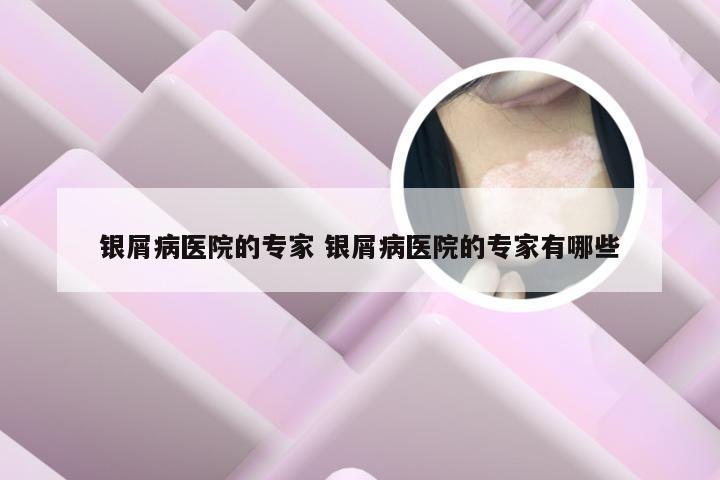 银屑病医院的专家 银屑病医院的专家有哪些