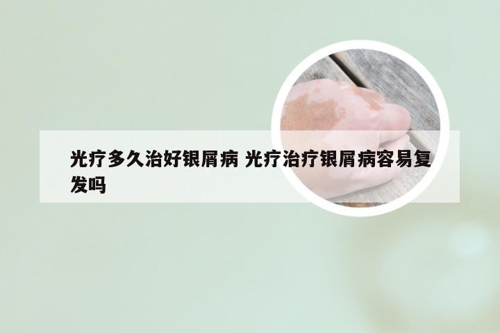 光疗多久治好银屑病 光疗治疗银屑病容易复发吗