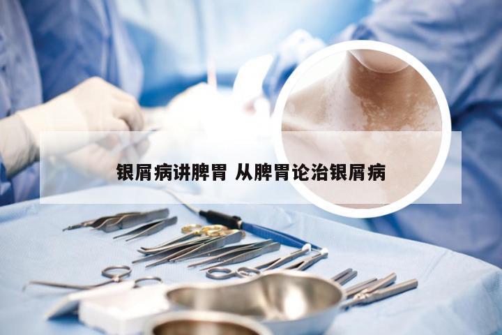 银屑病讲脾胃 从脾胃论治银屑病