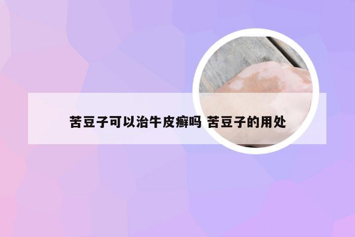 苦豆子可以治牛皮癣吗 苦豆子的用处