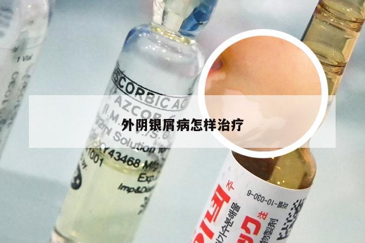 外阴银屑病怎样治疗