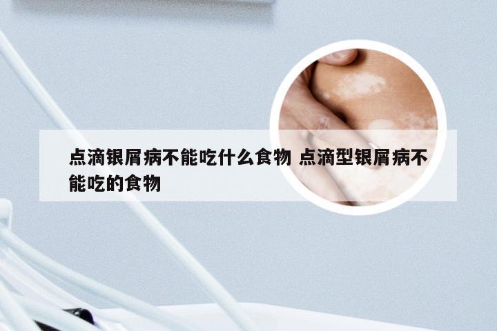 点滴银屑病不能吃什么食物 点滴型银屑病不能吃的食物