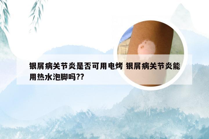 银屑病关节炎是否可用电烤 银屑病关节炎能用热水泡脚吗??