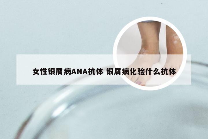 女性银屑病ANA抗体 银屑病化验什么抗体