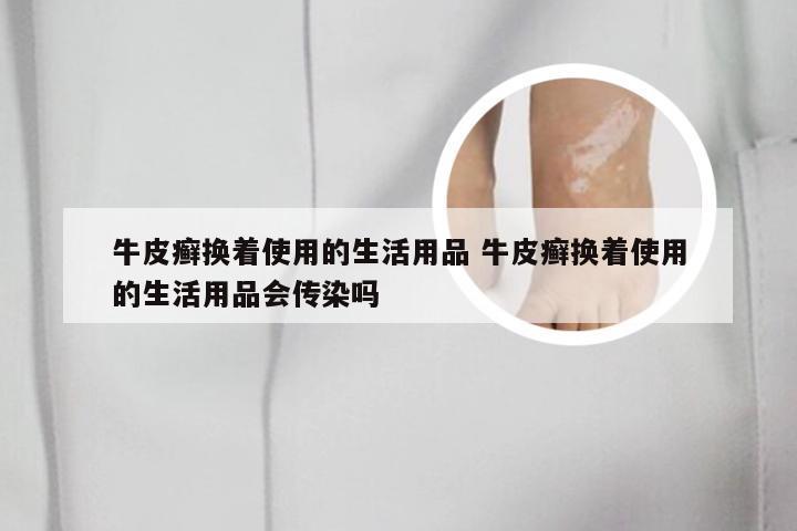 牛皮癣换着使用的生活用品 牛皮癣换着使用的生活用品会传染吗