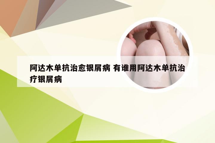阿达木单抗治愈银屑病 有谁用阿达木单抗治疗银屑病