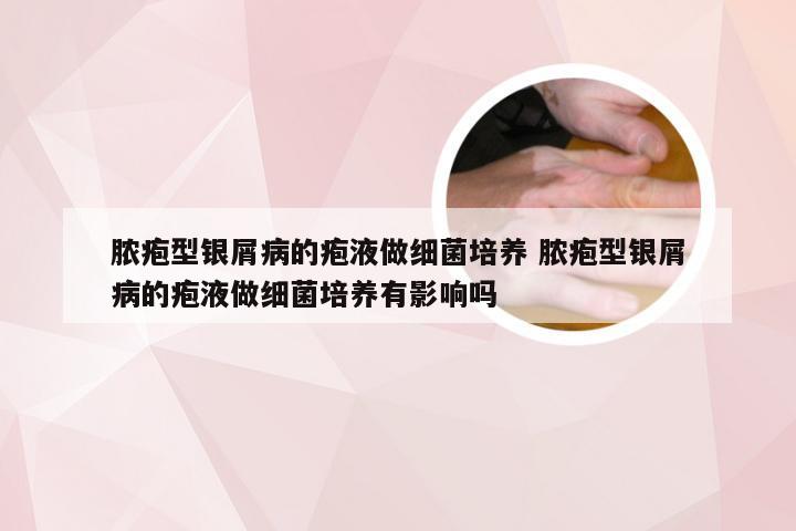 脓疱型银屑病的疱液做细菌培养 脓疱型银屑病的疱液做细菌培养有影响吗