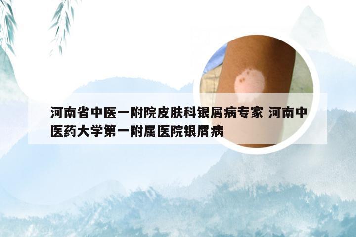 河南省中医一附院皮肤科银屑病专家 河南中医药大学第一附属医院银屑病