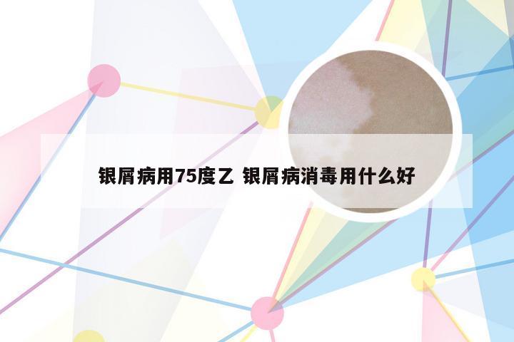 银屑病用75度乙 银屑病消毒用什么好