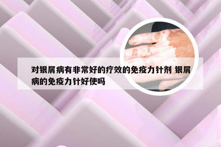 对银屑病有非常好的疗效的免疫力针剂 银屑病的免疫力针好使吗