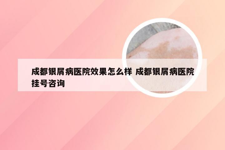 成都银屑病医院效果怎么样 成都银屑病医院挂号咨询