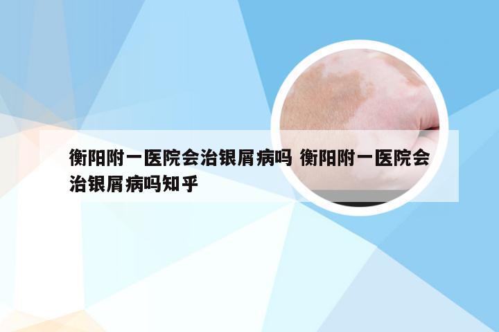 衡阳附一医院会治银屑病吗 衡阳附一医院会治银屑病吗知乎