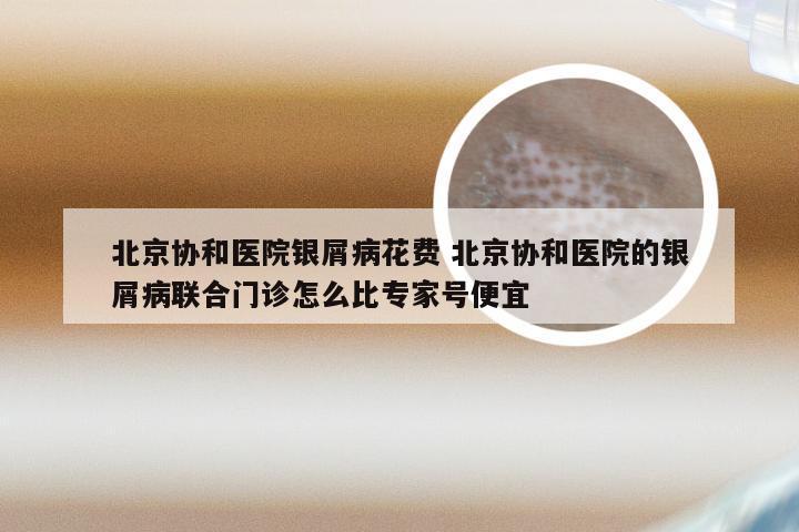 北京协和医院银屑病花费 北京协和医院的银屑病联合门诊怎么比专家号便宜