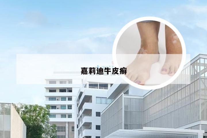 嘉莉迪牛皮癣