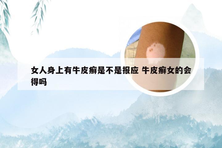 女人身上有牛皮癣是不是报应 牛皮癣女的会得吗