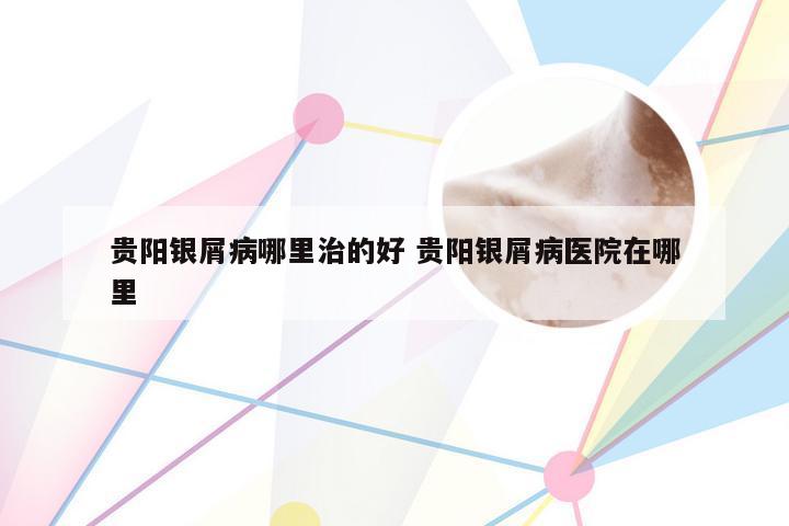贵阳银屑病哪里治的好 贵阳银屑病医院在哪里