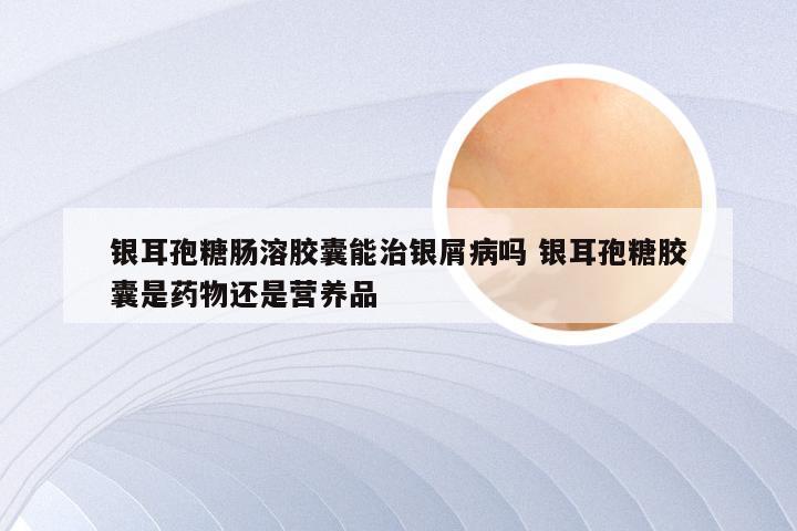 银耳孢糖肠溶胶囊能治银屑病吗 银耳孢糖胶囊是药物还是营养品