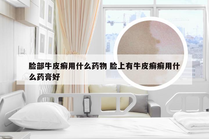脸部牛皮癣用什么药物 脸上有牛皮癣癣用什么药膏好