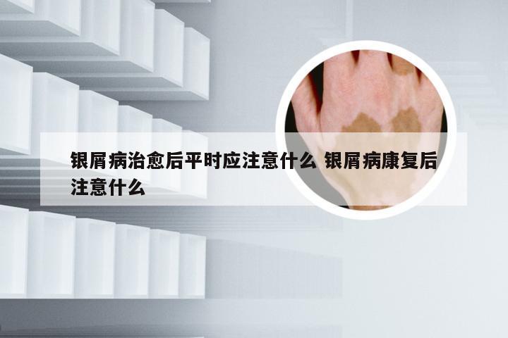 银屑病治愈后平时应注意什么 银屑病康复后注意什么