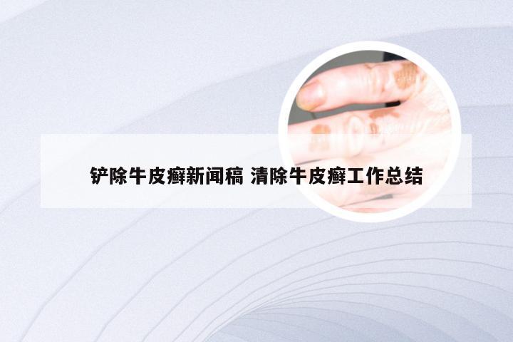 铲除牛皮癣新闻稿 清除牛皮癣工作总结