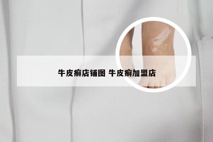 牛皮癣店铺图 牛皮癣加盟店