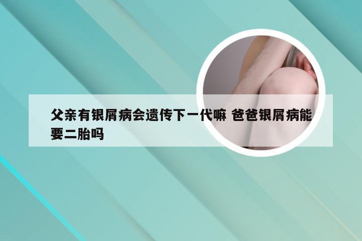 父亲有银屑病会遗传下一代嘛 爸爸银屑病能要二胎吗