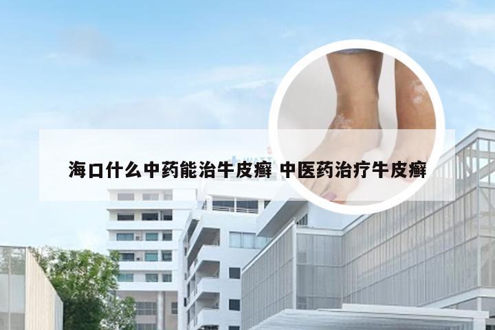 海口什么中药能治牛皮癣 中医药治疗牛皮癣