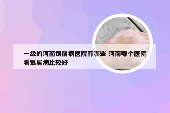 一级的河南银屑病医院有哪些 河南哪个医院看银屑病比较好