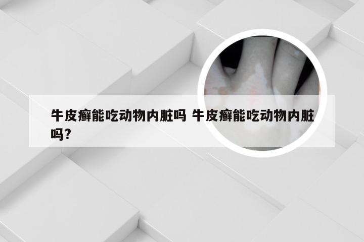 牛皮癣能吃动物内脏吗 牛皮癣能吃动物内脏吗?