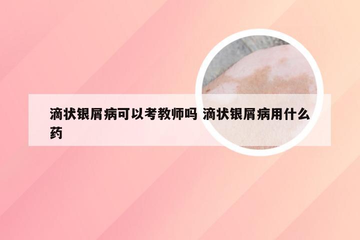 滴状银屑病可以考教师吗 滴状银屑病用什么药