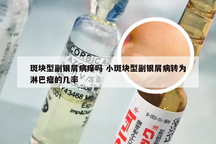 斑块型副银屑病痒吗 小斑块型副银屑病转为淋巴瘤的几率