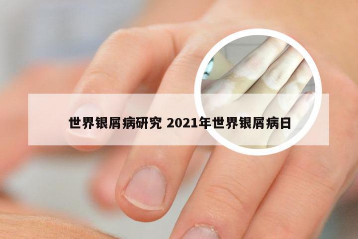 世界银屑病研究 2021年世界银屑病日